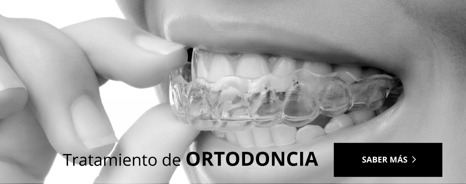 ortodoncia najera